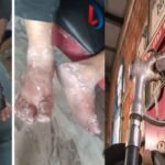 Petrol Pump की लापरवाही: गैस रिसाव की वजह से चापानल में लगी आग, तीन युवक झुलसे