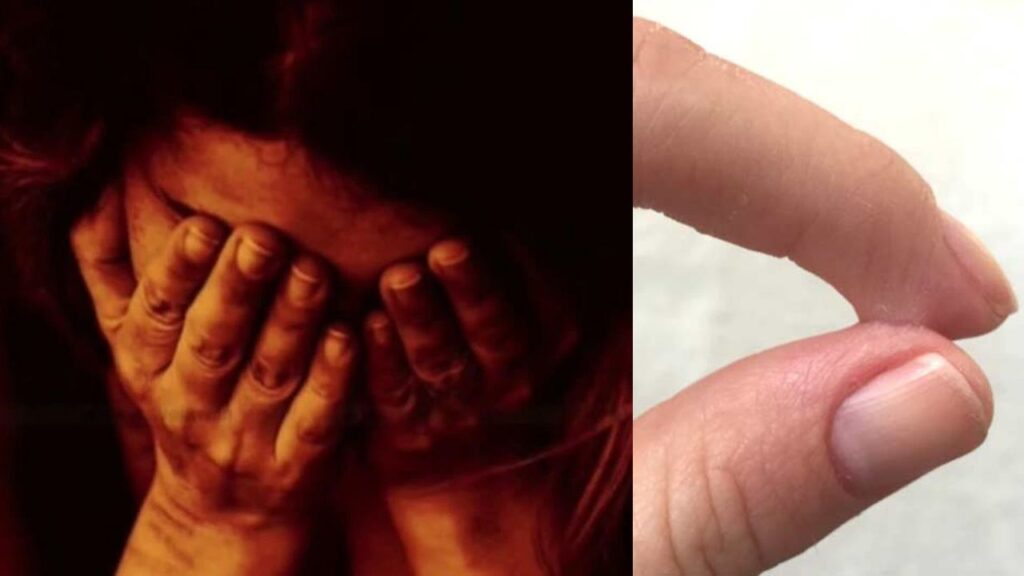 सौतन ने पति के साथ मिलकर महिला के प्राइवेट पार्ट्स में डाला फेवीक्विक, अस्पताल में कराया गया भर्ती