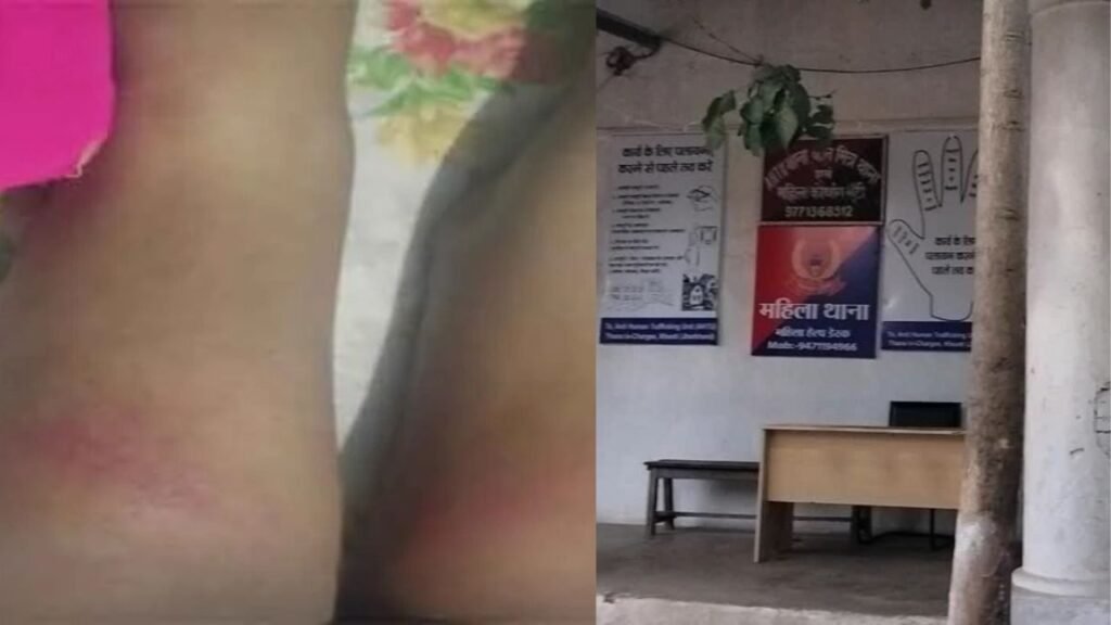 खूंटी पुलिस पर नाबालिग को पीटने का गंभीर आरोप, मानव तस्करी के आरोपी के बेटे को थाने में पीटा