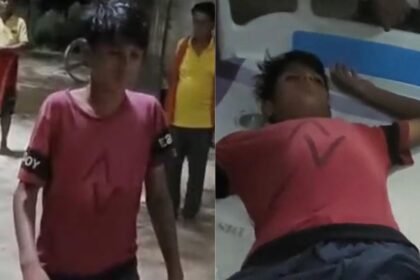 बिहार में 'मामा' कहने पर 12 साल के बच्चे को पुलिस ने बेरहमी पीटा, अस्पताल में चल रहा है इलाज