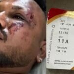 Air India Plane Crash: चमत्कार होते है! विमान हादसे में एक मात्र जिंदा बचे यात्री ने कहा- जब मैं उठा तो ....