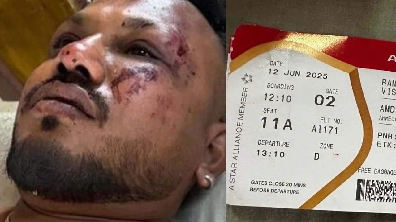 Air India Plane Crash: चमत्कार होते है! विमान हादसे में एक मात्र जिंदा बचे यात्री ने कहा- जब मैं उठा तो ....