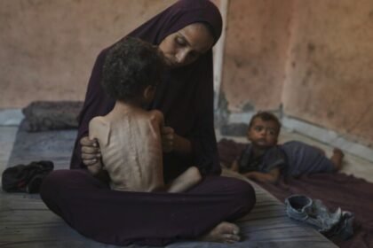 gaza child starvation