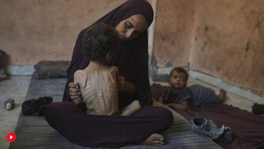 gaza child starvation