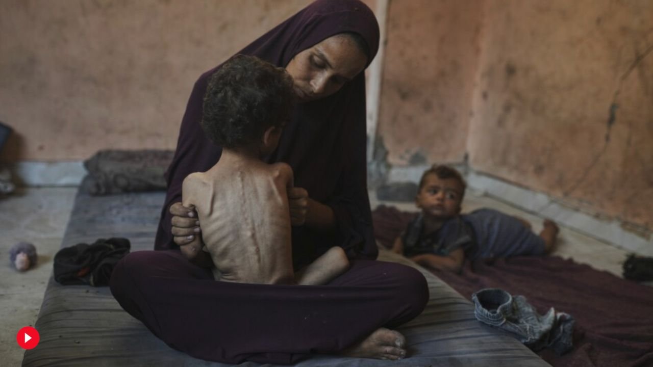gaza child starvation