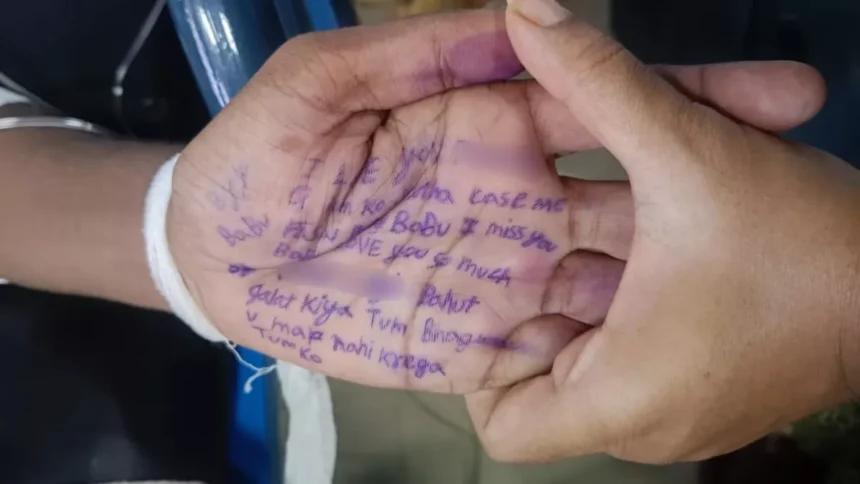 नाबालिग से दुष्कर्म के आरोप में सजा काट रहे कैदी ने की आत्महत्या की कोशिश, हाथ पर लिखा-आई लव यू बाबू, मुझे झूठे केस..