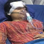 मुखिया के बेटे ने शराब के नशे में कार से स्कूटी सवार को कुचला, भाई की मौत, बहन लड़ रही हैं जिंदगी की जंग