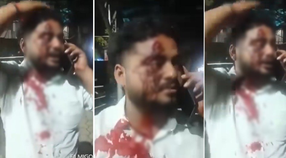 रांची के कावेरी रेस्टूरेंट में ग्राहक के साथ गुंडागर्दी, खाना में देरी की शिकायत पर जमकर पीटा, VIDEO हुआ वायरल