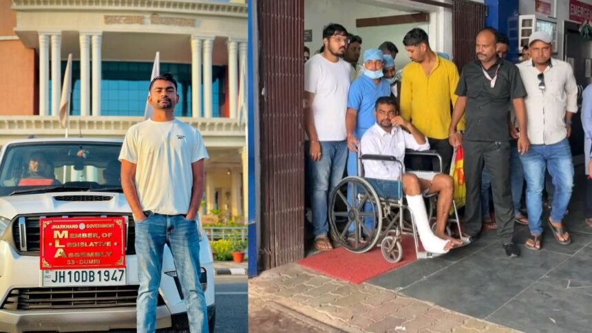 जयराम महतो का पैर हुआ फ्रैक्चर, फुटबॉल खेलने के दौरान लगी चोट