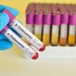thalassemia