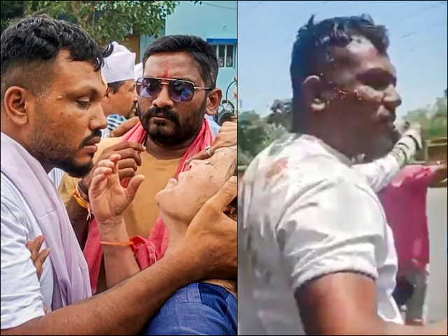 Air-India-Crash-Survivor-Vishwashkumar