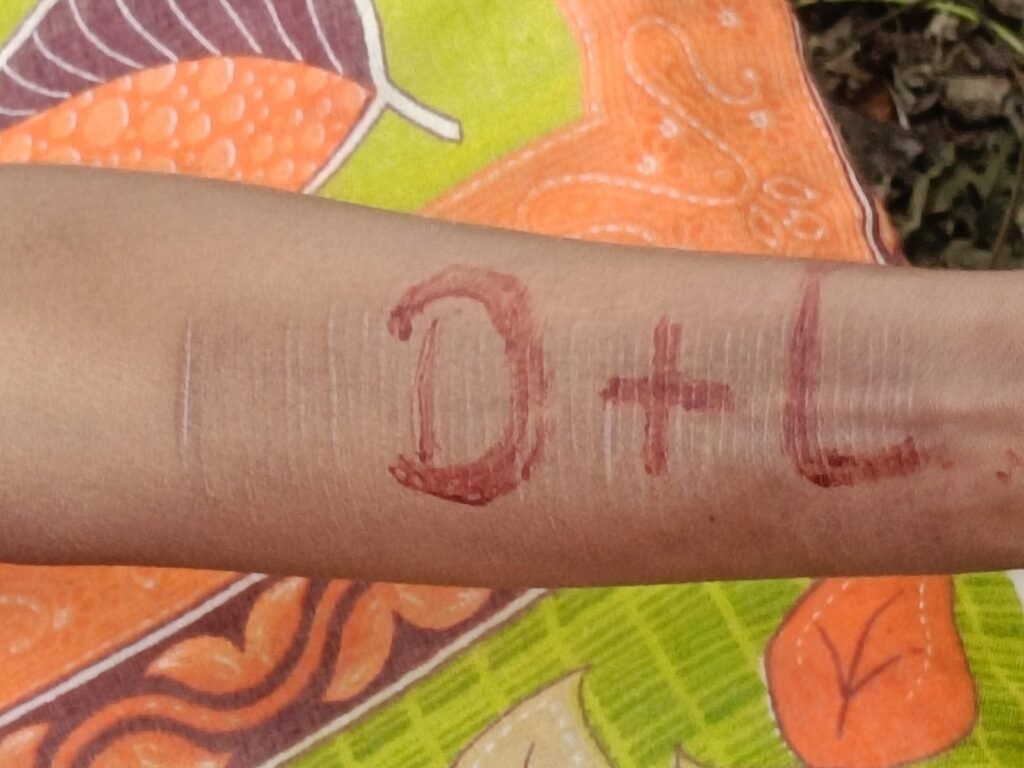 पूर्वी सिंहभूम के धालभूमगढ़ में मिला नाबालिग लड़की का शव, प्रेम प्रसंग की आशंका, मृतका के हाथ पर लिखा मिला “D + L”