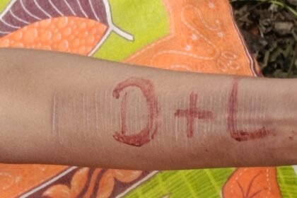 पूर्वी सिंहभूम के धालभूमगढ़ में मिला नाबालिग लड़की का शव, प्रेम प्रसंग की आशंका, मृतका के हाथ पर लिखा मिला “D + L”