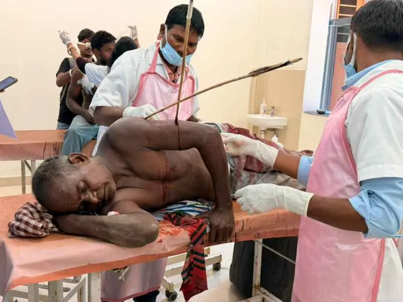 चाईबासा में सब्जी बेचने जा रहे ग्रामीण पर तीर-धनूष से हमला, 3 तीर शरीर में धंसे, हालत गंभीर
