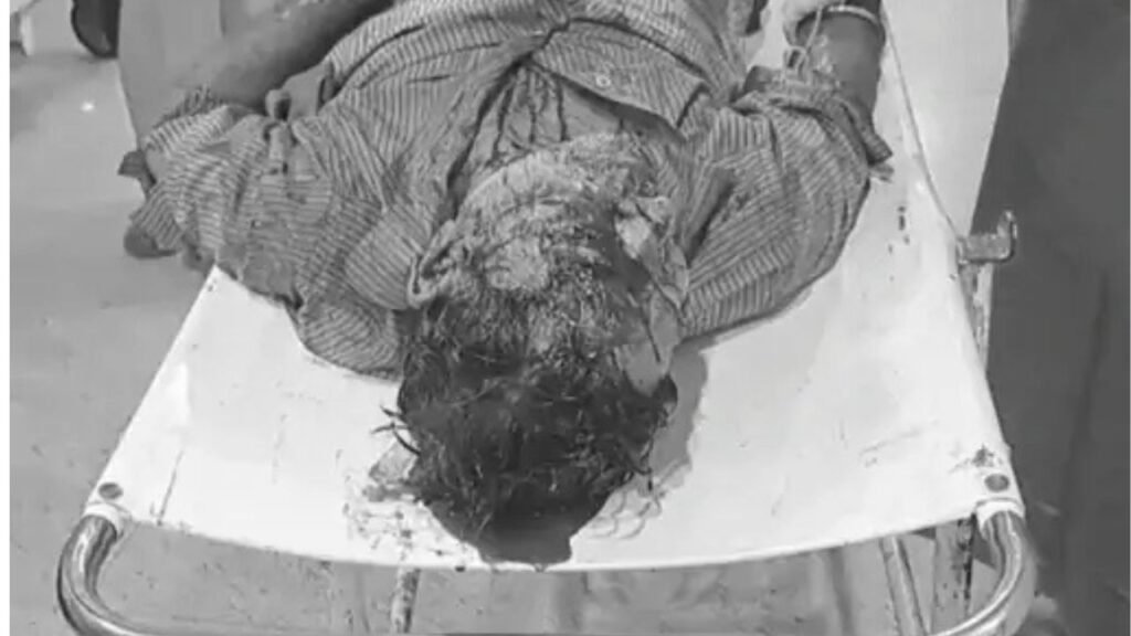 जमशेदपुर में पिता को 'भूत' समझकर बेटे ने चापड़ से मारा, लोगों ने अस्पताल में कराया भर्ती