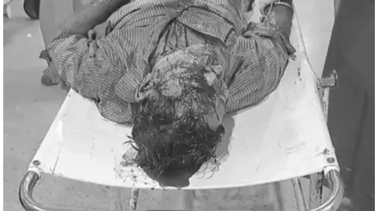जमशेदपुर में पिता को 'भूत' समझकर बेटे ने चापड़ से मारा, लोगों ने अस्पताल में कराया भर्ती