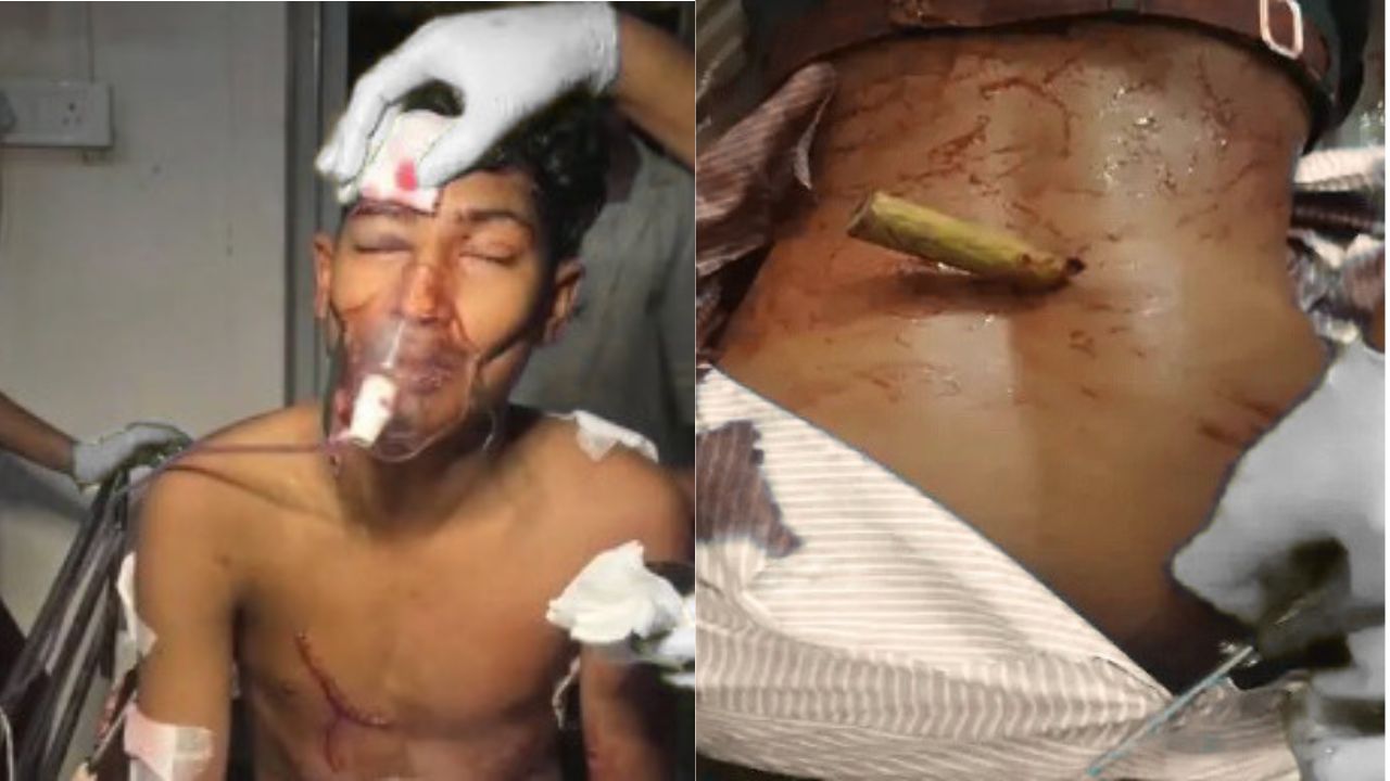 रांची के मांडर में युवती के प्रेमी ने स्कूल गेट के बाहर छात्र को 20 बार चाकू से गोदा, हालत गंभीर