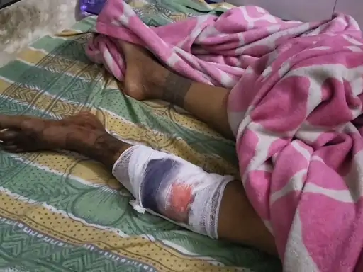 हजारीबाग में आदिवासी महिला से दुष्कर्म और मारपीट का आरोप, दो आरोपी गिरफ्तार