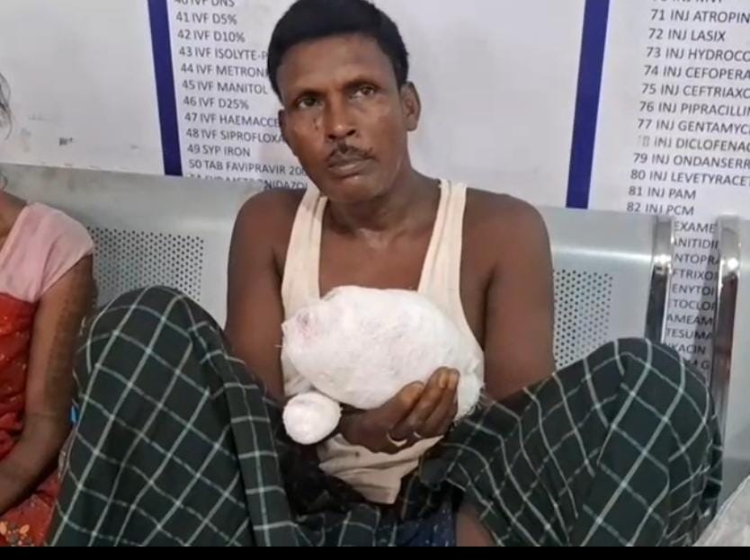 पलामू के जंगल में खुखड़ी चुनने के दौरान बम विस्फोट, ग्रामीण का हाथ बुरी तरह जख्मी